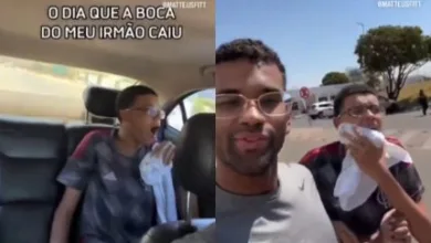 Jovem após passar por procedimento para recolocação da mandíbula