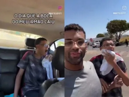 Jovem após passar por procedimento para recolocação da mandíbula